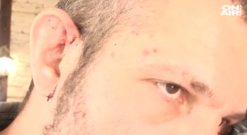 Роми пребиха зверски петима в заведение в Дунавци