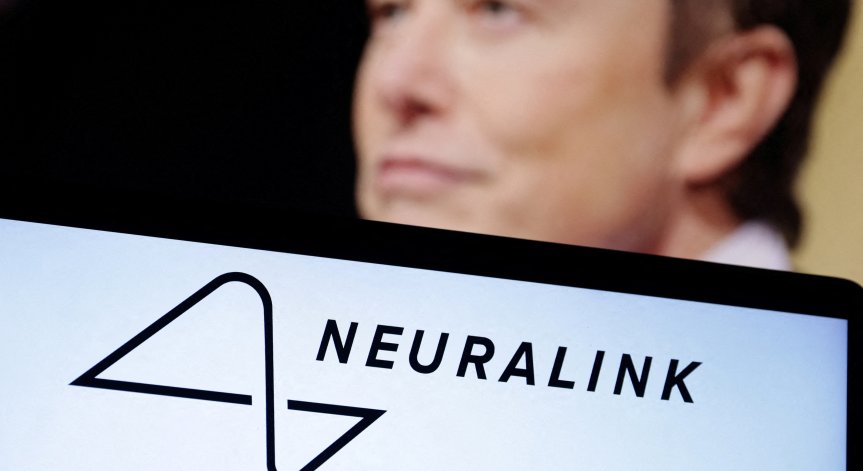 Neuralink продължава напред.