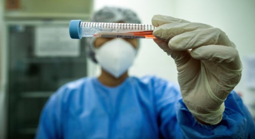 Новите случаи на коронавируса са 81, хоспитализираните са 2 283 души