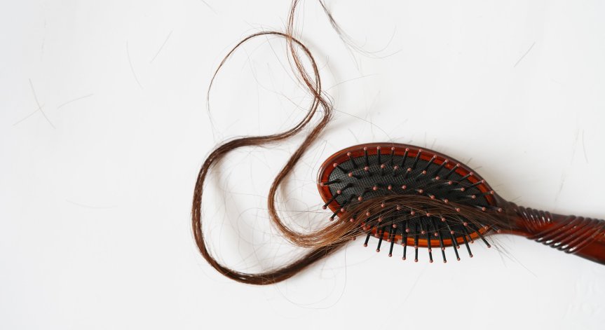 5 билки, които идват на помощ срещу косопада