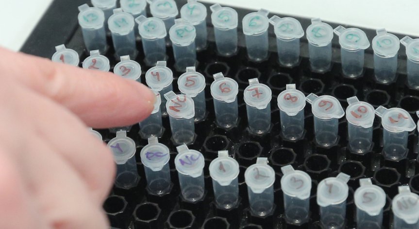 Ковид-19 за денонощието: Трима починали, 47 заразени и 72-ма ваксинирани (ОБНОВЕНА)