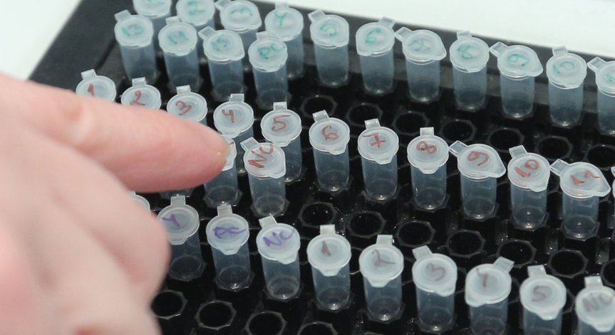 Един починал с Ковид-19, заразените са повече от вчера