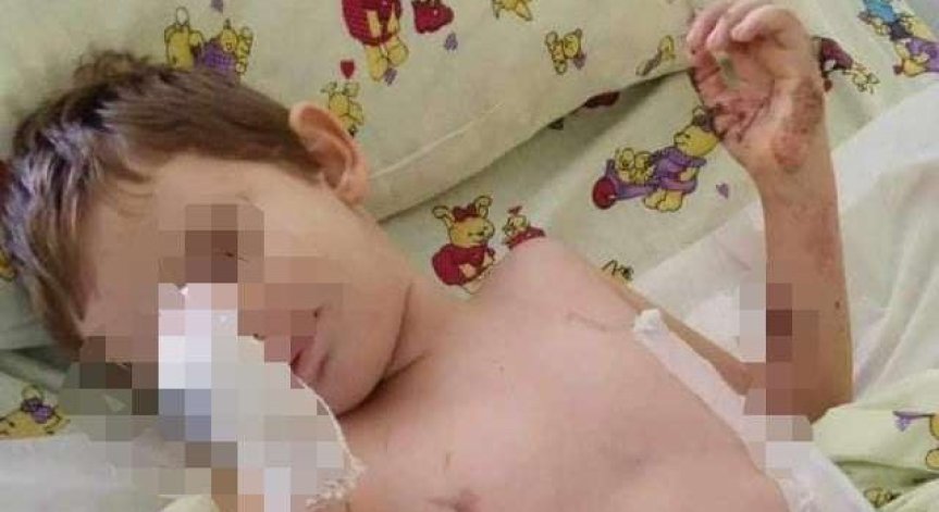 Домът им изгоря: Малкият Унут е с 30% изгаряния, майка му с повече