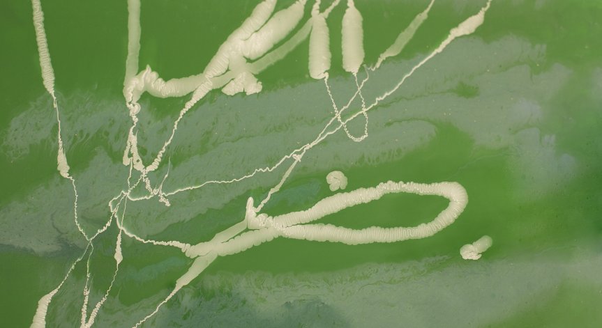 Лекарите открили паразита след рязко влошаване на състоянието.