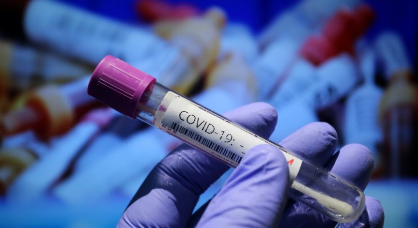 За денонощието: 349 новозаразени и 20 починали (ОБНОВЕНА)