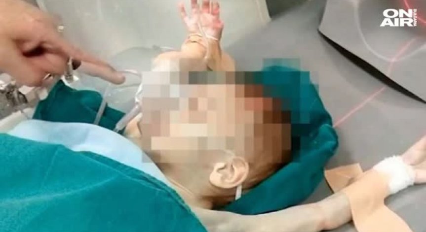 Пловдивска болница прие две близначета със съмнение за домашно насилие