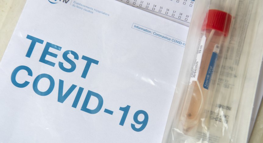 Необяснима болест спря тестовете за ваксина на Johnson & Johnson