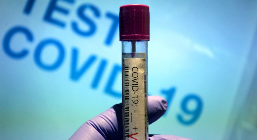  20 работници са заразени с Ковид-19 в Стара Загора