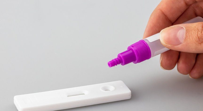 82 нови случая на Ковид-19 за денонощие, в болница са постъпили 13 души