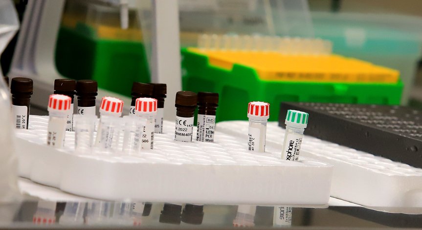 Защо е важно да се направи PCR тест преди ваксинация срещу Ковид-19?