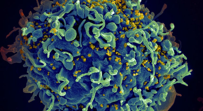 Лекари излекуваха бебе, родено с HIV