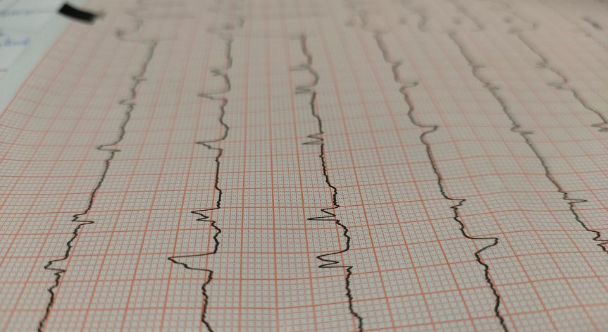 Пневмонията е сред възможните странични ефекти.