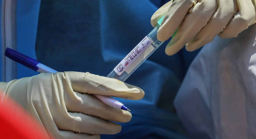 661 са заразените с Ковид-19 у нас, още двама души са починали