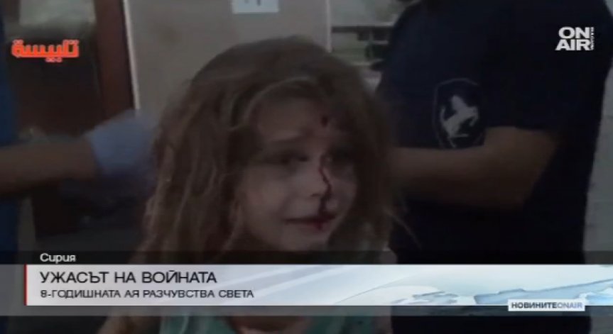Ранено 8-годишно сирийче стана символ на грозното лице на войната