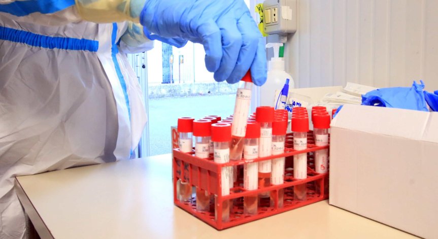 552 са новите случаи на Ковид-19 у нас, 61 души са починали