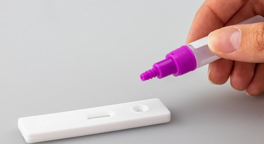 Ковид-19 за последното денонощие: 76 нови случаи и нито един починал (ОБНОВЕНА)