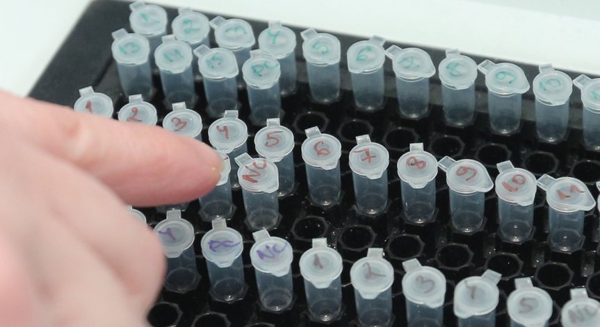 Ковид-19 отстъпва: 32 са новите случаи, в болници остават 168 пациенти