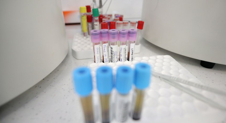 29 починали и 1472 заразени при 8738 PCR теста