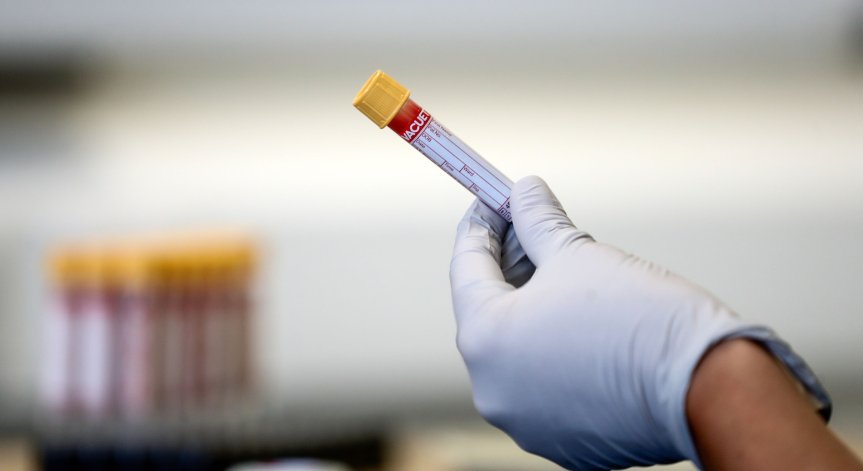 232-ма новозаразени с Ковид-19 при 5393 теста, шестима са починали