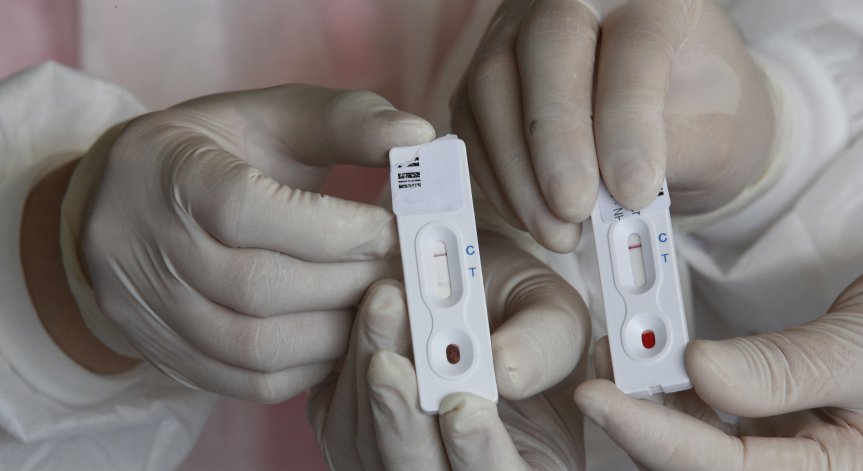 1 милион американци тествани за коронавирус, жертвите са 3000