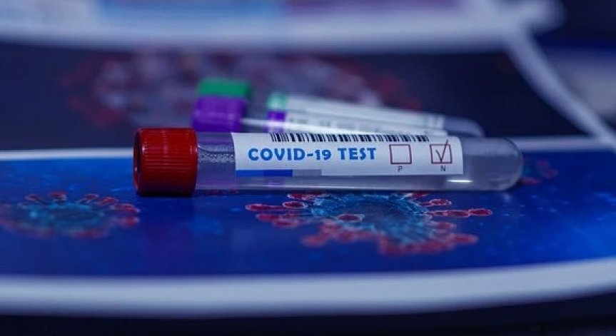 Настаняване в специализирани институции - само с отрицателен PCR тест