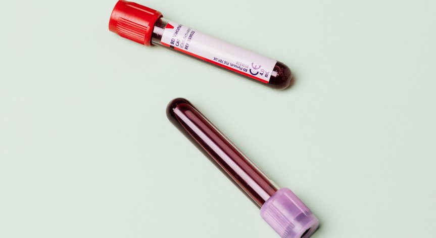 Поставят оздравелите от Дома за възрастни в Русе под карантина