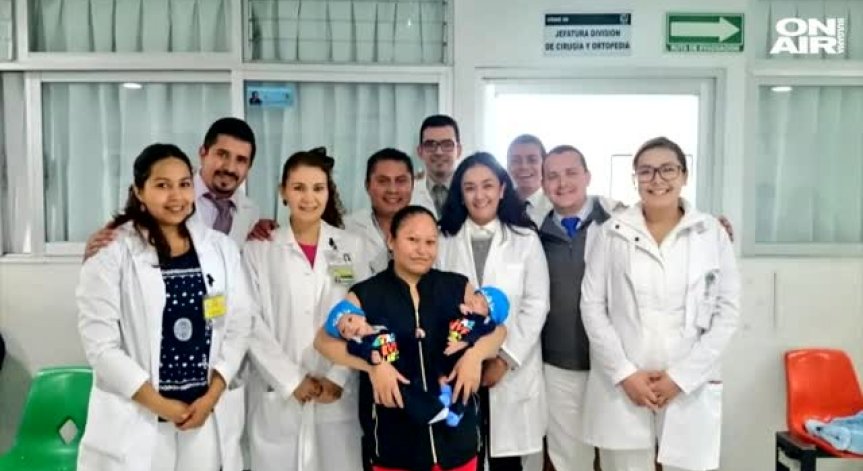 Разделиха успешно мексикански сиамски близнаци