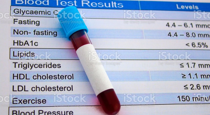 7 начина да поддържате здравословни нива на холестерол