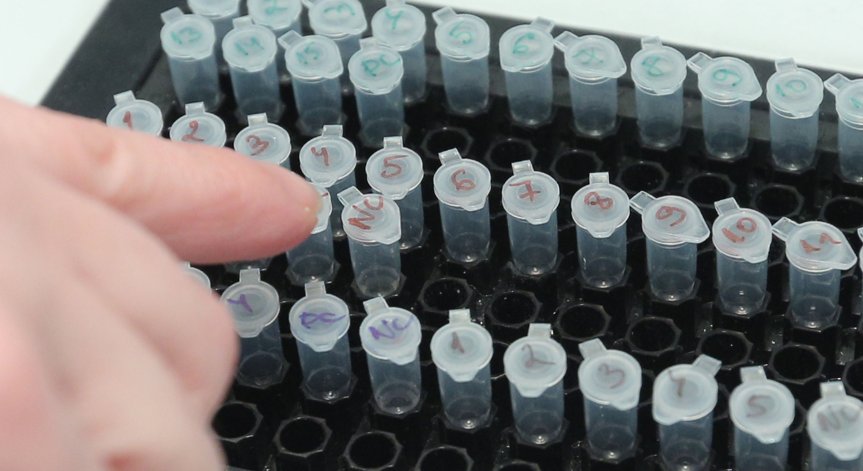 Регистрираха първия случай на грип в България този сезон