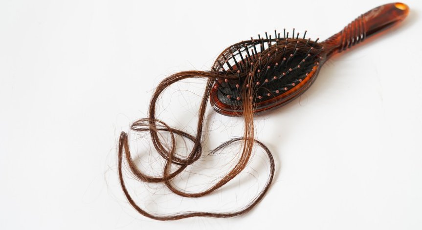 Как да се справим с косопада по естествен начин?