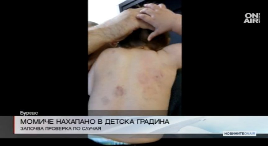 Скандал в Бургас заради нахапано в детска ясла момиченце