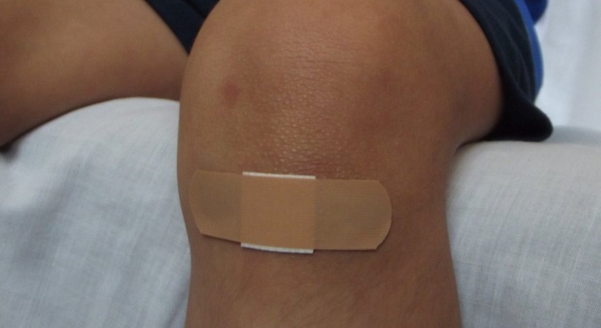 Откриха нов механизъм при възстановяването на раните на кожата