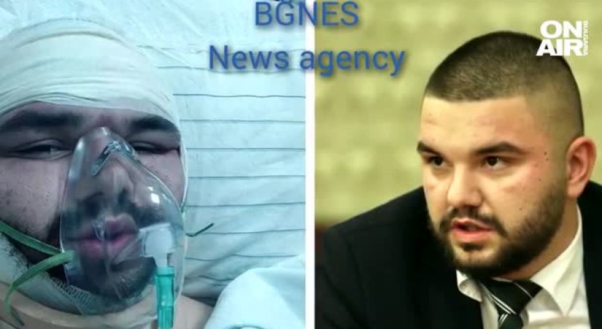 Пребитият 23-годишен българин в Охрид е със спукани прешлени, ребра и счупена челюст