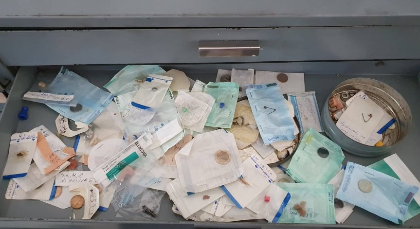 Извадиха сачми от носа на дете, престояли в него цели 2 години