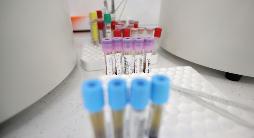 Един починал и 135 новозаразени с коронавирус за денонощието