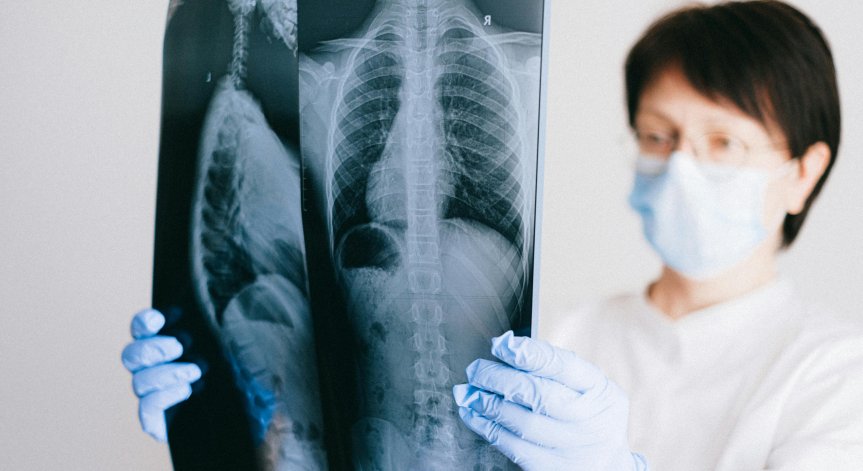 Учените напредват в създаването на изкуствен бял дроб