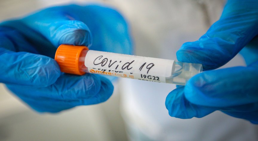 9 починали с Ковид-19 за ден и 376 новозаразени за денонощието