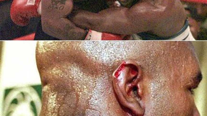 <p>Железния Майк се оправда, че отхапал част от ухото, защото Холифилд го подлудил чрез умишлени удари с глава</p>